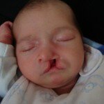 1 mese (5)